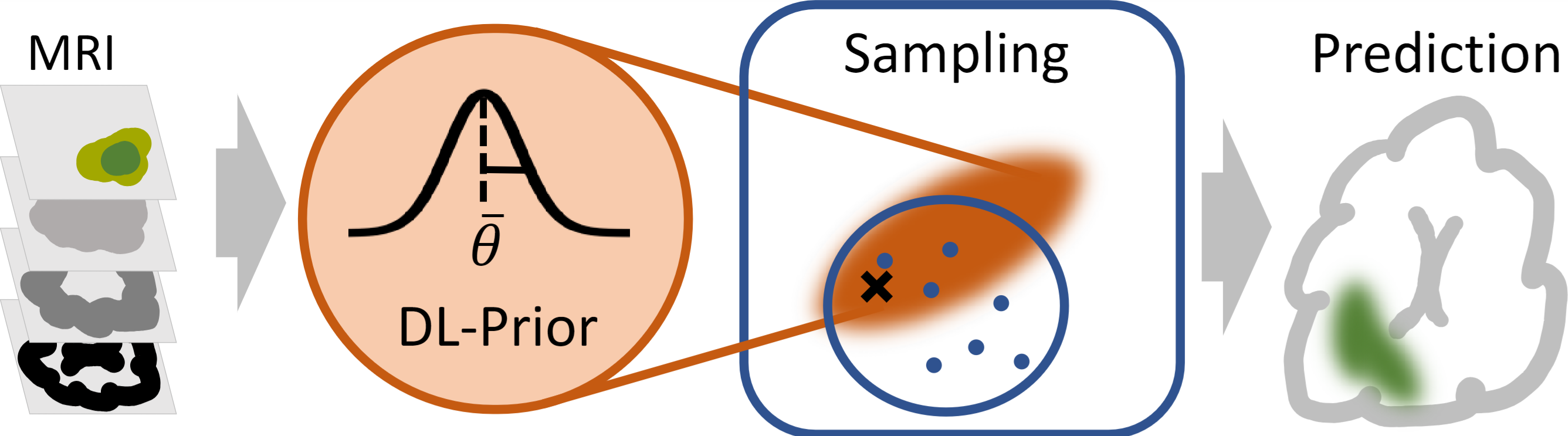 DL-Prior